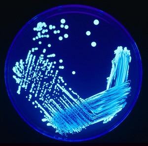 Legionella sp. colonies growing on an agar plate and illuminated using ultraviolet light to increase contrast.